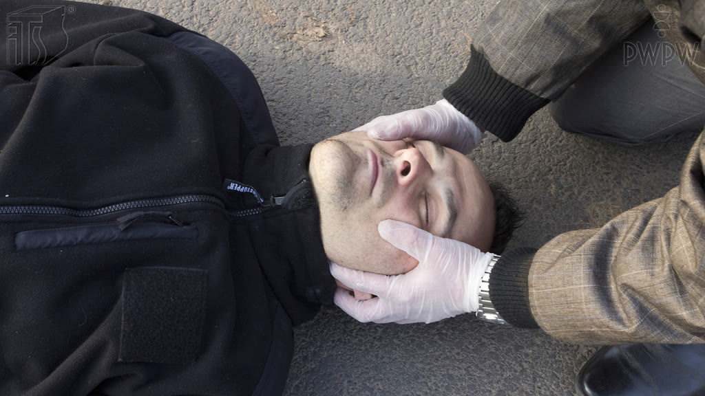 Ілюстрація до питання: Як довго потрібно вручну стабілізувати голову потерпілого, якщо є підозра травми шийного відділу хребта?